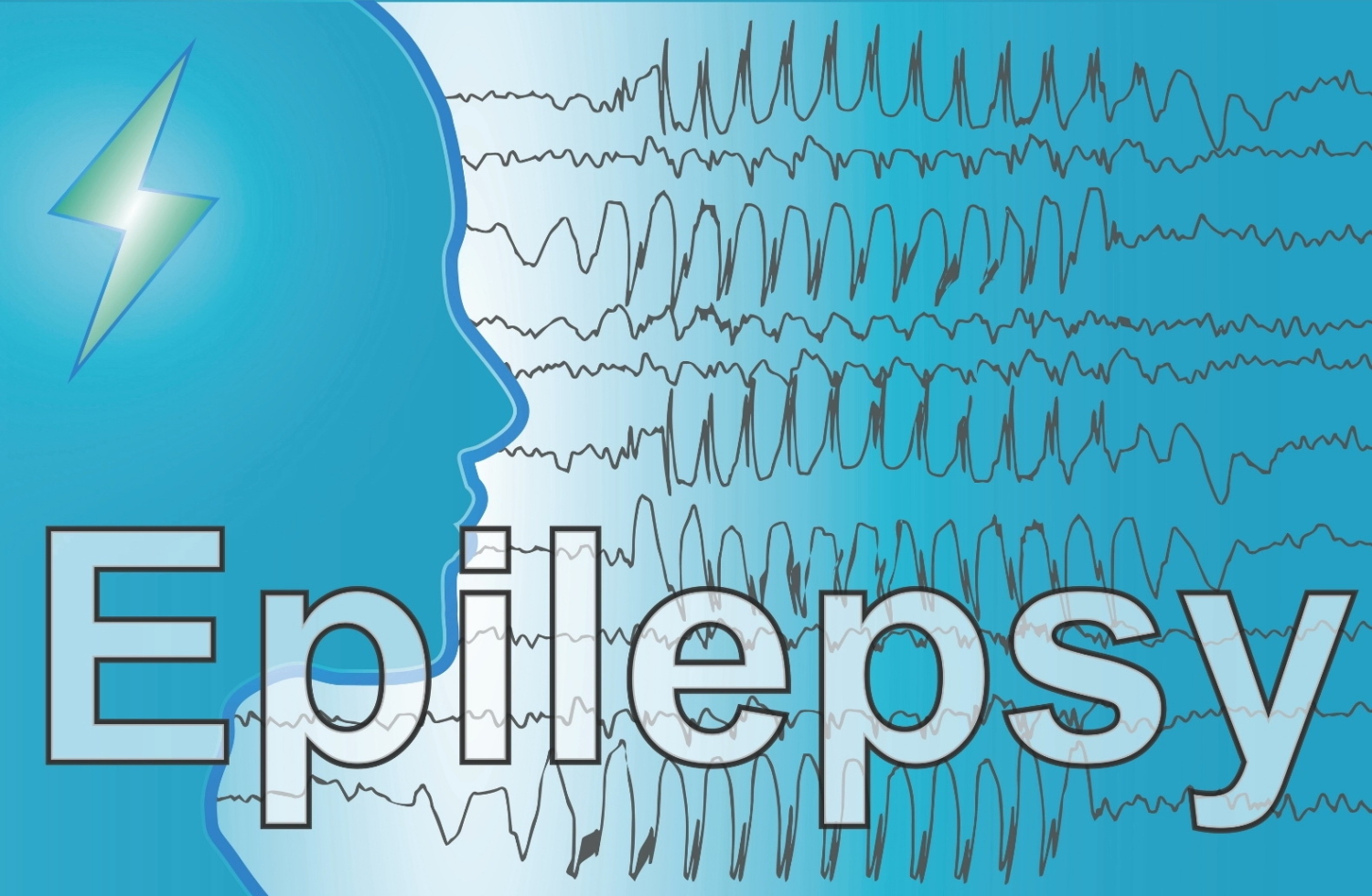 EPILEPSIE INFORMATION FÜR PATIENTEN The Basics Neurologie Afradi